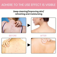 Fruit Acid Body Lotion for Women - Summer Hydration with Long Lasting Fragrance