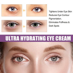 Moisturizing Eye Cream 15g for Dark Circles & Eye Bags