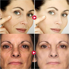 10Pcs Collagen Smile Line Patch For Facial Smile Line Lifting