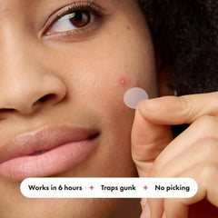 Acne Patches Waterproof Concealer 100 Non Toxic Effective