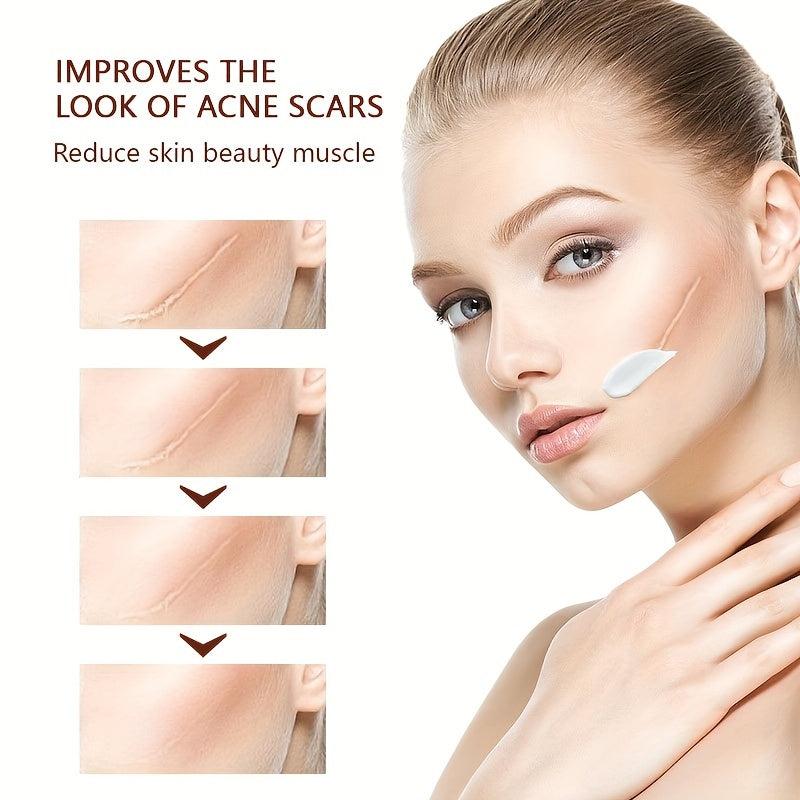Scar Cream Mark Anti-inflammatory Repair Cream 30ml