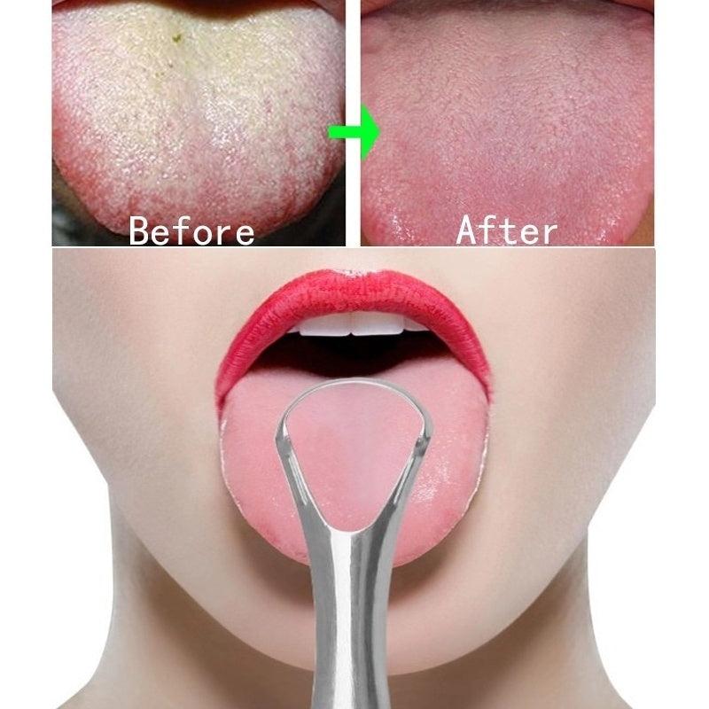 304 Stainless Steel Tongue Scraper Remove Halitosis