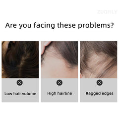 Hairline Shadow Stick Hair Shading Sponge Pen Waterproof Hair Root Concealer