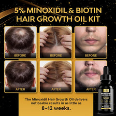 Minoxidil Biotin Hair Serum for Healthy Hair Growth