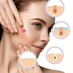Acne Patch Pink Heart Shaped Hydrocolloid Acne Patches For Face