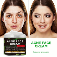 Acne Cream with Niacinamide & Salicylic Acid