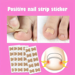 Ingrown Toenail Correction Stickers for Men and Women Foot Care Patch