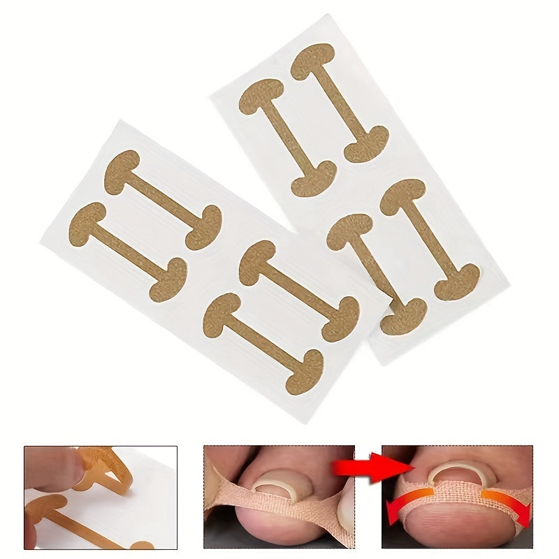 40 Toenail Correction Patches - Ingrown Nail Bone Patch - 10 Sheets