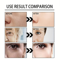 Retinol & Hyaluronic Acid Face Cream